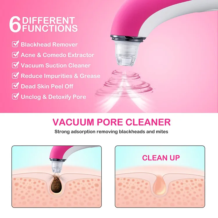 4 in 1 USB Rechargeable Facial Pore Cleaner Blackhead Remover Vacuum