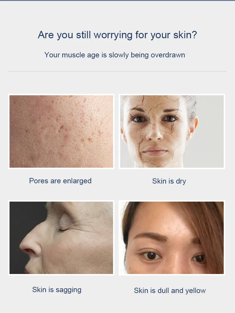 Cheap Acne Blackhead Vacuum Remover Beauty Personal Care Acne Removal