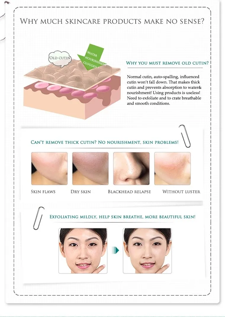 Deep Gel Scrub Smooth Moisturizing Skin Care Whitening Face Cream Anti Aging Repair Exfoliator Scrub