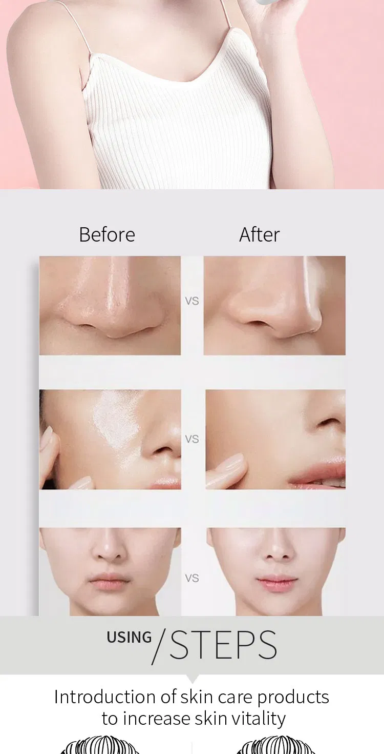 Portable Facial Dead Skin Peeling Machine Professional Sonic Face Cleaning Spatula Ultrasonic Skin Scrubber