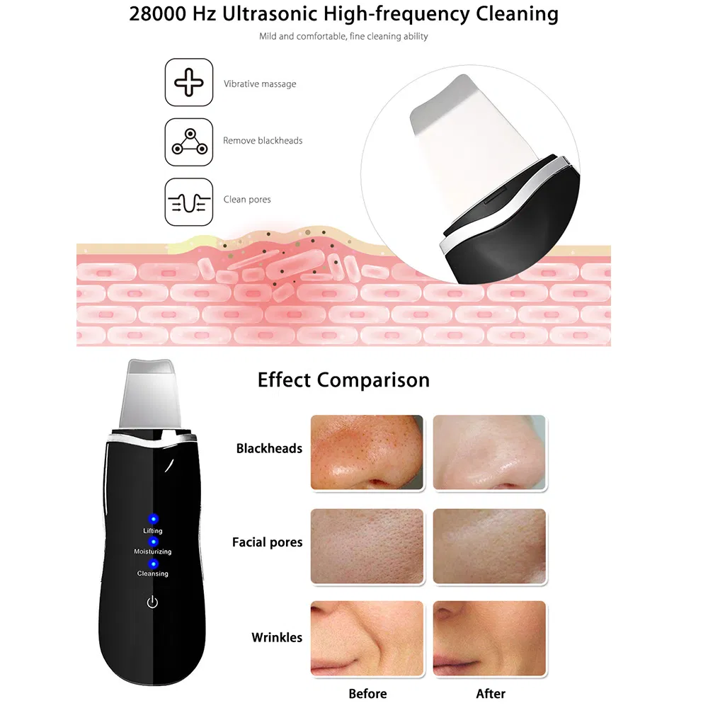 Ultrasonic Face Cleaning Skin Scrubber Facial Peeling Deep Cleansing Exfoliator Pore Cleaner Blackhead Removal Skin Care Tool