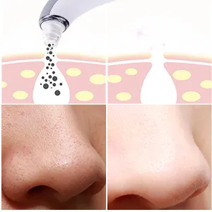 Vacuum Nose Facial Blackhead Remover for Beauty