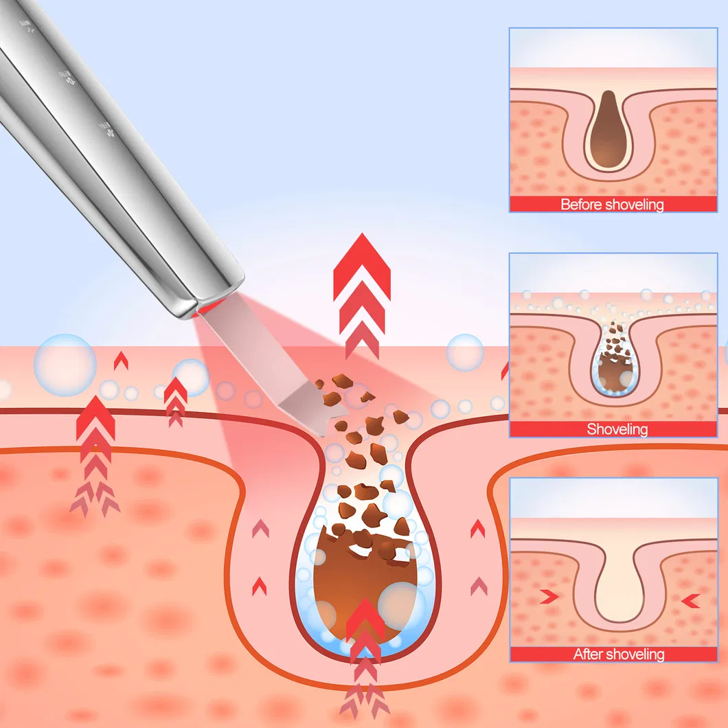 Wholesale Ultrasonic Skin Scrubber Multi-Functional Beauty Equipment for Women Home Use Dead Skin Blackhead Remove